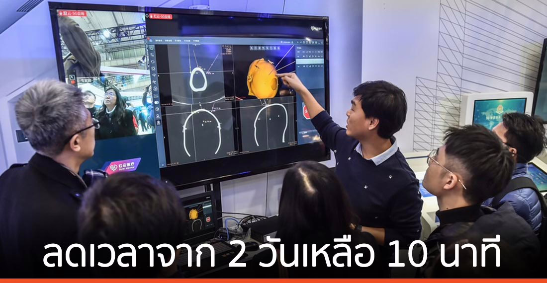 แพทย์จีนใช้หุ่นยนต์ 5G อัลตราซาวด์-รักษาผู้ป่วยทางไกล