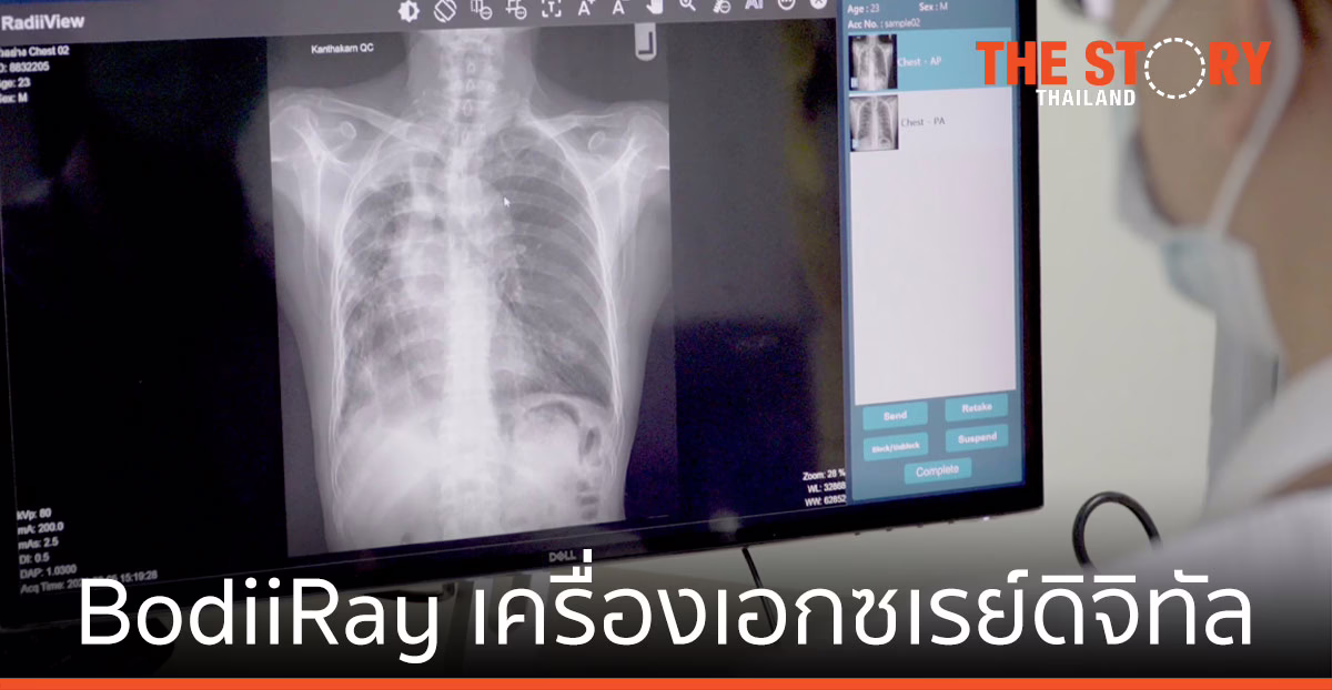BodiiRay เครื่องเอกซเรย์ดิจิทัล นวัตกรรมไทยทำ เพื่ออุตสาหกรรมเครื่องมือแพทย์ที่ยั่งยืน