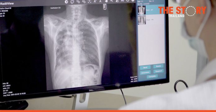 BodiiRay: Digital x-ray machines by Thai Innovators play vital role in COVID-19 crisis