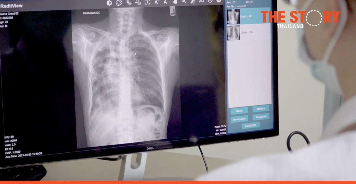 BodiiRay: Digital x-ray machines by Thai innovators play vital role in COVID-19 crisis