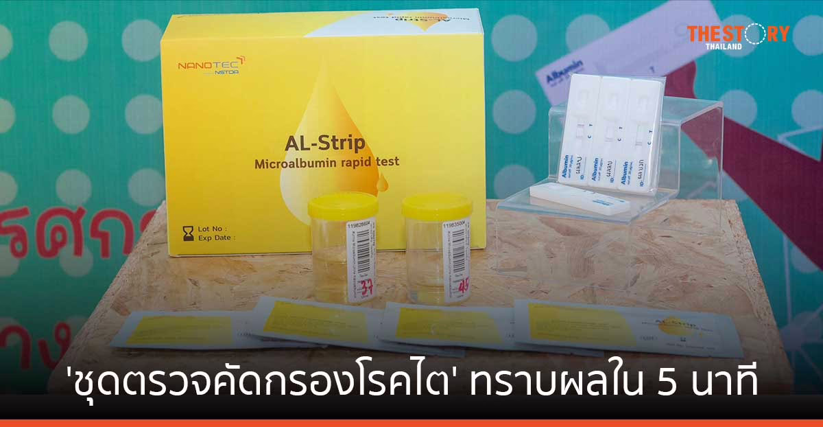นักวิจัยนาโนเทค คิดค้น ‘ชุดตรวจคัดกรองโรคไต’ ทราบผลใน 5 นาที