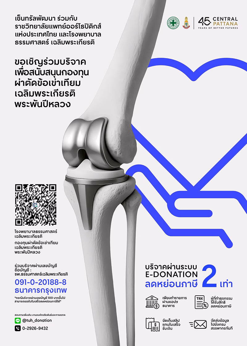 เซ็นทรัล จับมือ ราชวิทยาลัยแพทย์ฯ เปิดพื้นที่ศูนย์การค้า 17 สาขา ตรวจกระดูกและข้อฟรี มี.ค.-เม.ย. 69