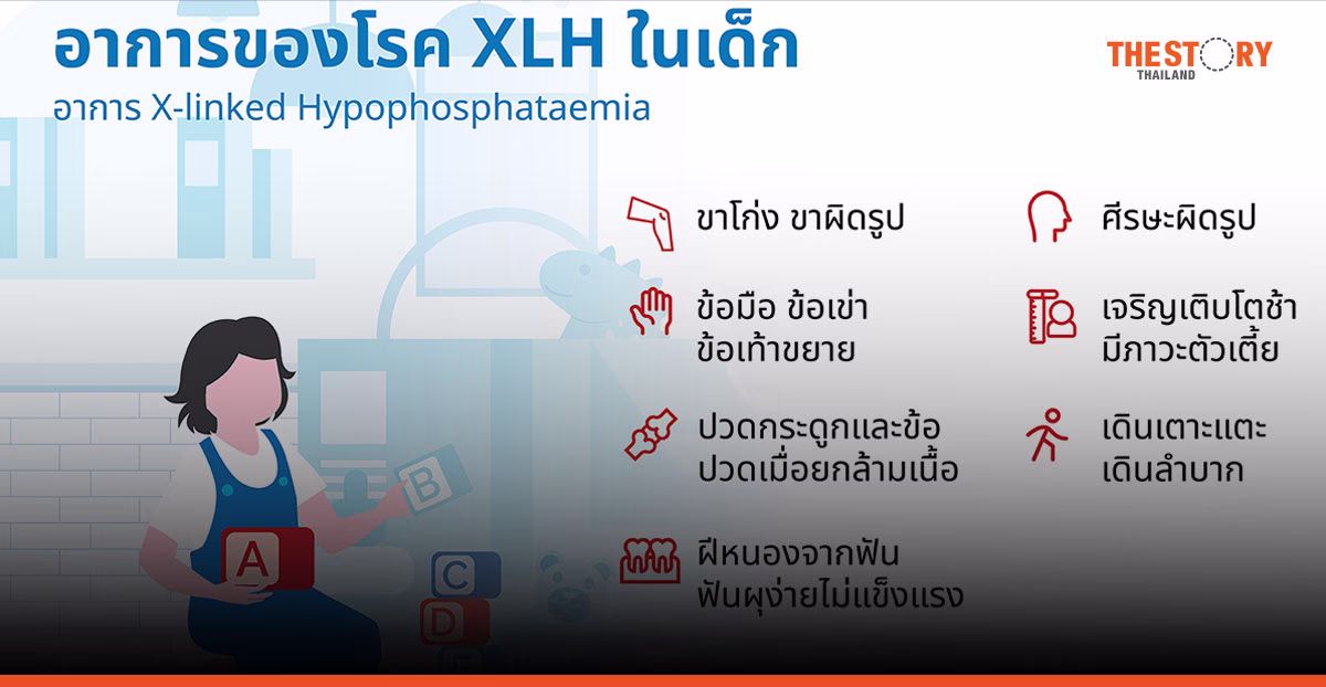 สมาคมต่อมไร้ท่อเด็กฯ ผนึก DKSH ร่วมสร้างการตระหนักรู้ และความเข้าใจเกี่ยวกับโรคหายาก XLH
